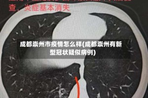 成都崇州市疫情怎么样(成都崇州有新型冠状疑似病例)